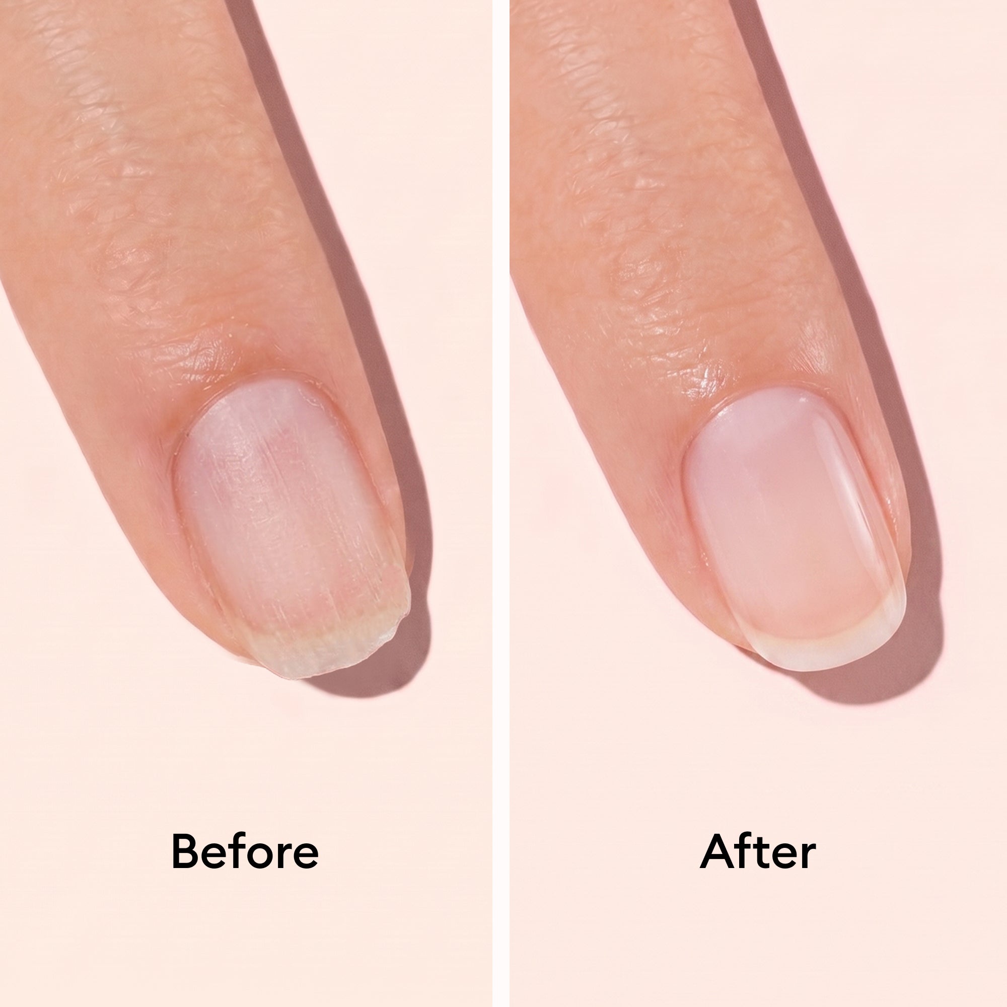 Repairing Treatment (Base SOS + Maska SOS)