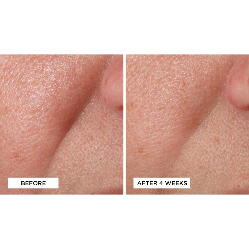 Cold Plasma Plus+ Advanced Serum Concentrate