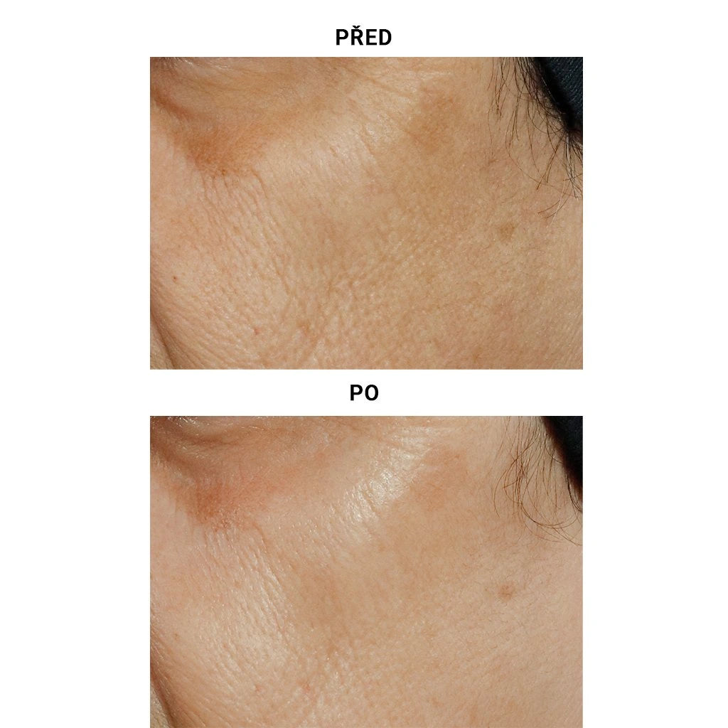 High Potency Triple Retinol Renewal Serum
