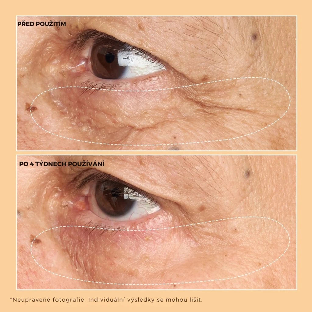 Neuropeptide Corrective Brightening Under-Eye Cream