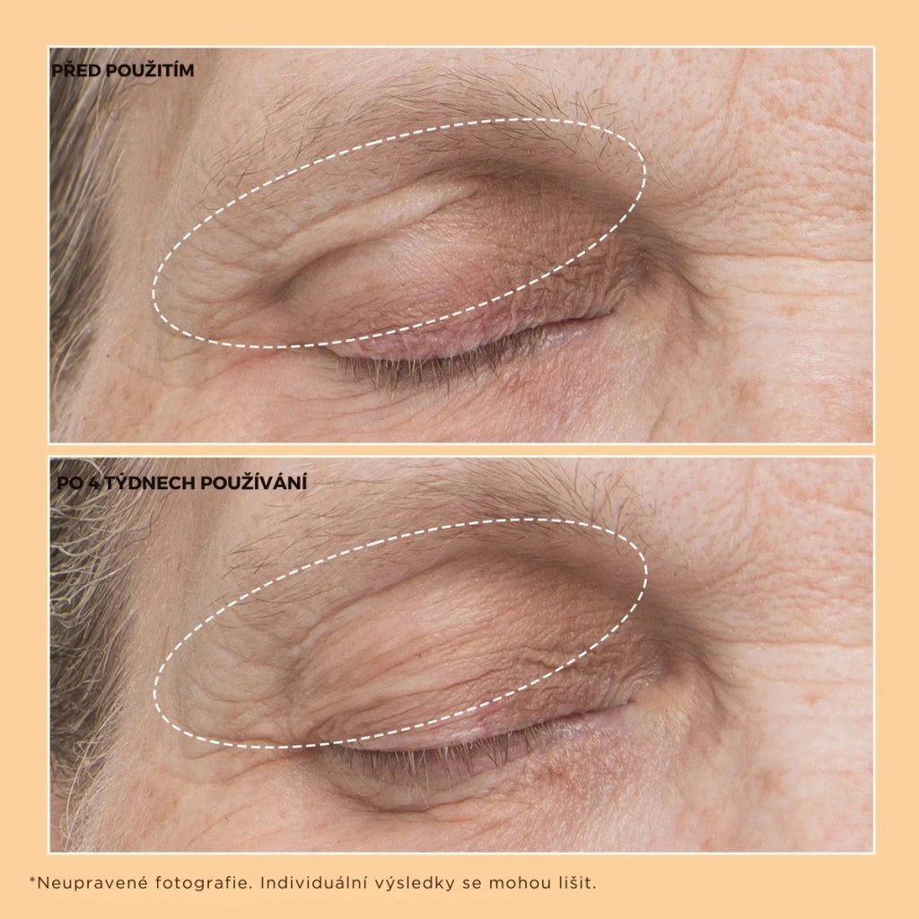Neuropeptide Eyelid Lift Serum
