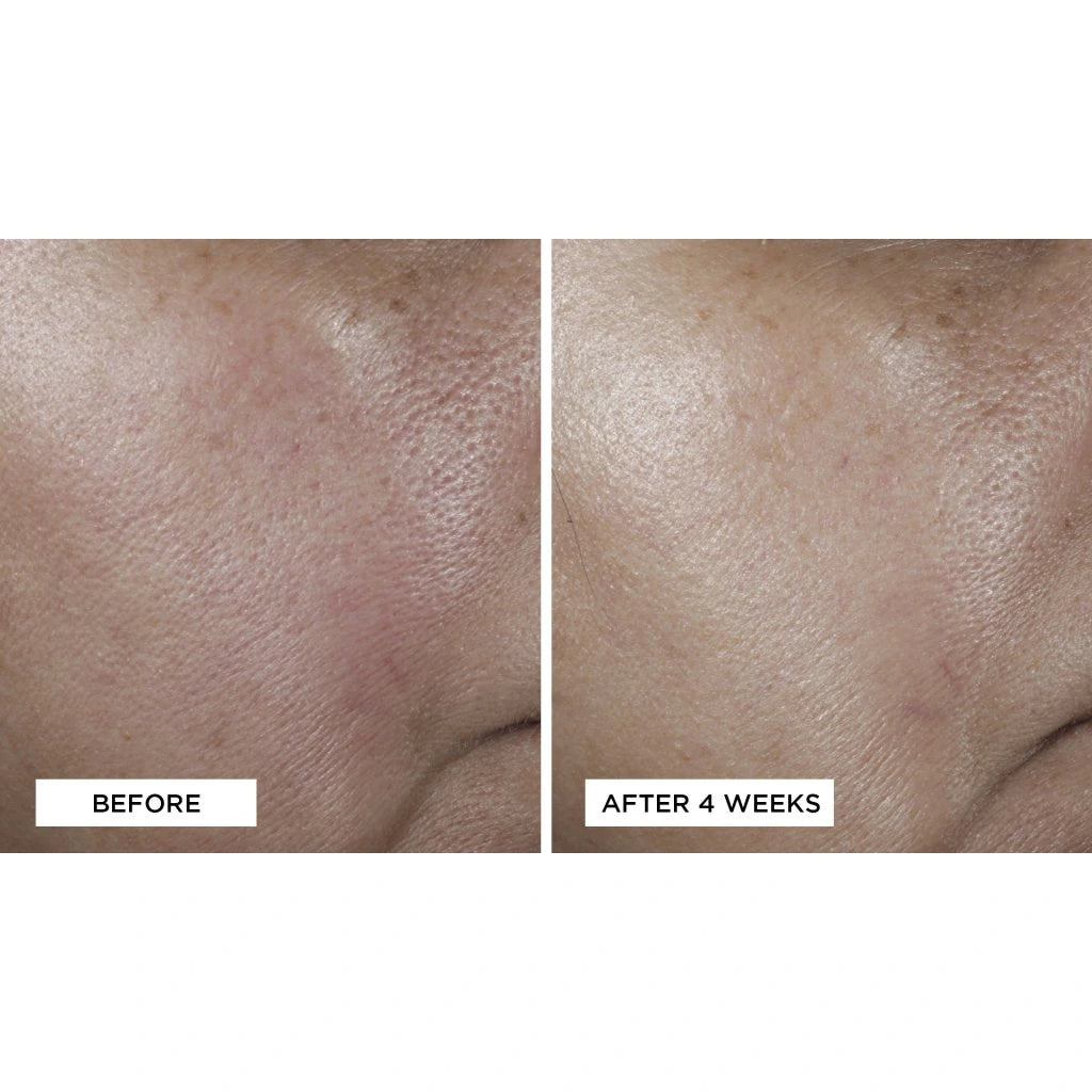 No:Rinse Intensive Pore Minimizing Toner