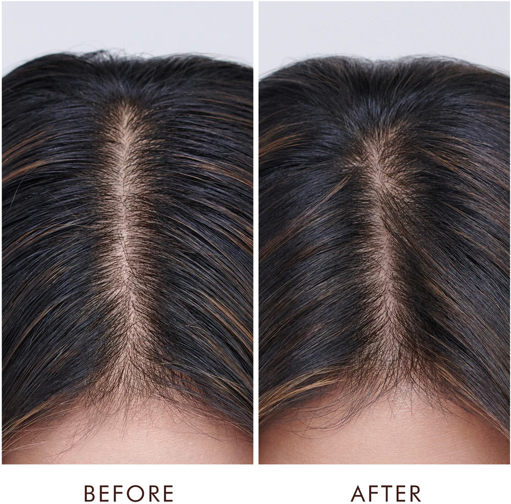 Oily Scalp Treatment